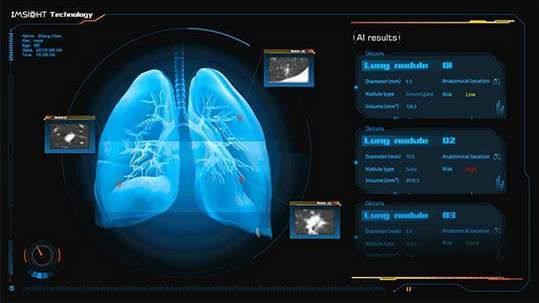 為了我們的健康 以AI賦能智能抗疫，數據處理與存儲支持服務探析